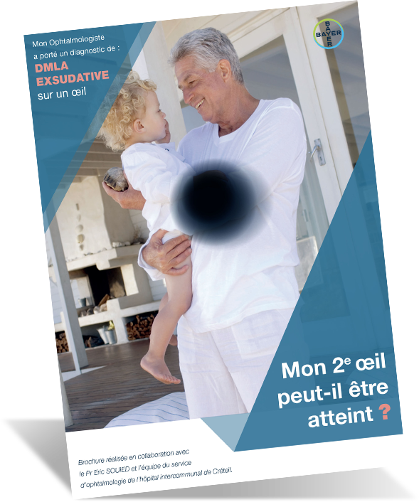 plus loin sur la DMLA exsudative